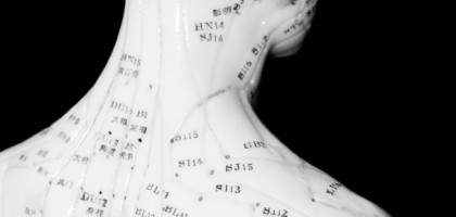 acupuncture1